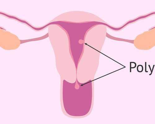 南京找代孕公司,郴州第一人民医院试管费用高吗做手术安全吗-南京供卵试管成