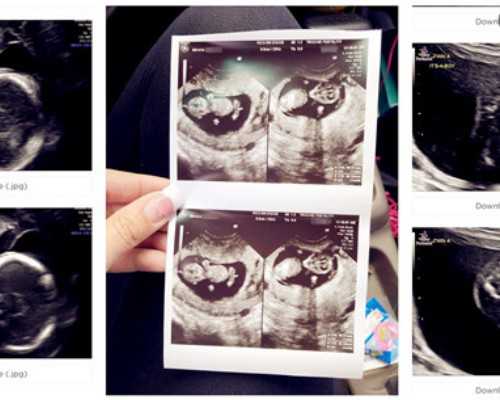 南京怎么判断是否代怀 南京妇幼保健院试管费用： ‘孕早期单子看男女准吗’