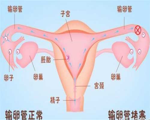 南京供卵试管联系方式,南京哪里可以做三代试管，价格是多少？