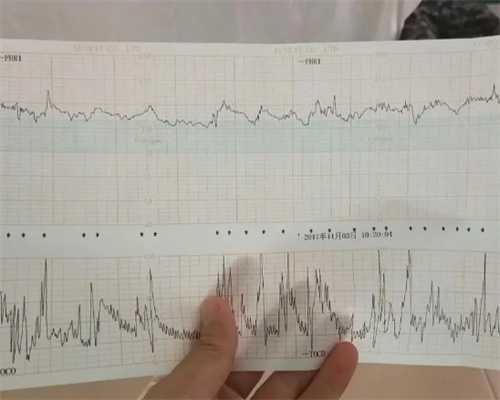 南京供卵正规吗,去香港做试管婴儿需要多长时间?-南京供卵医院成功率_一个月