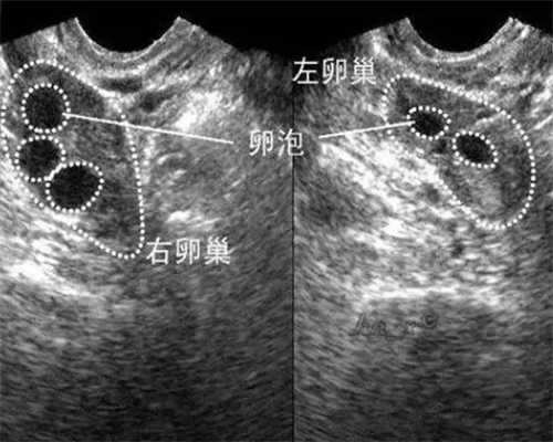 南京代孕是自己的孩子么,36岁试管婴儿能顺产吗-上海供卵试管双胞胎-南京公立